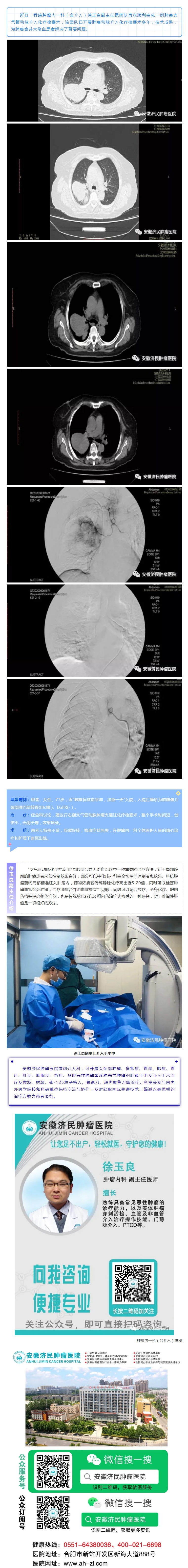 【肺癌的微创介入治疗】我院已开展肺癌支气管动脉介入化疗栓塞术多年.png